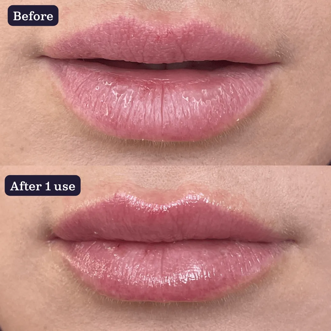 Juicy Lips Duo