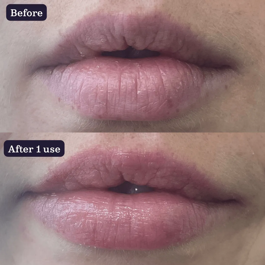 Juicy Lips Duo
