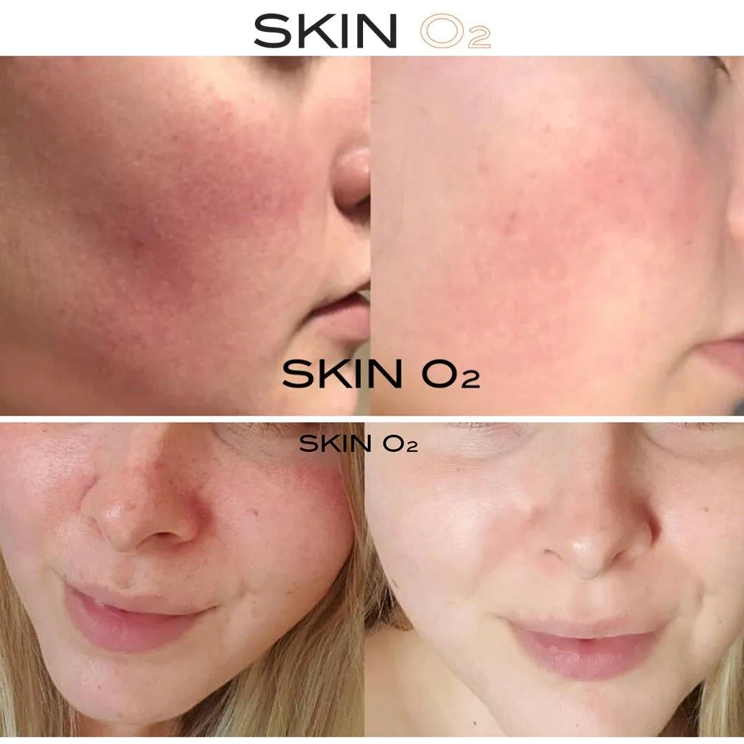 Plus C Serum   Free Peptide Mask